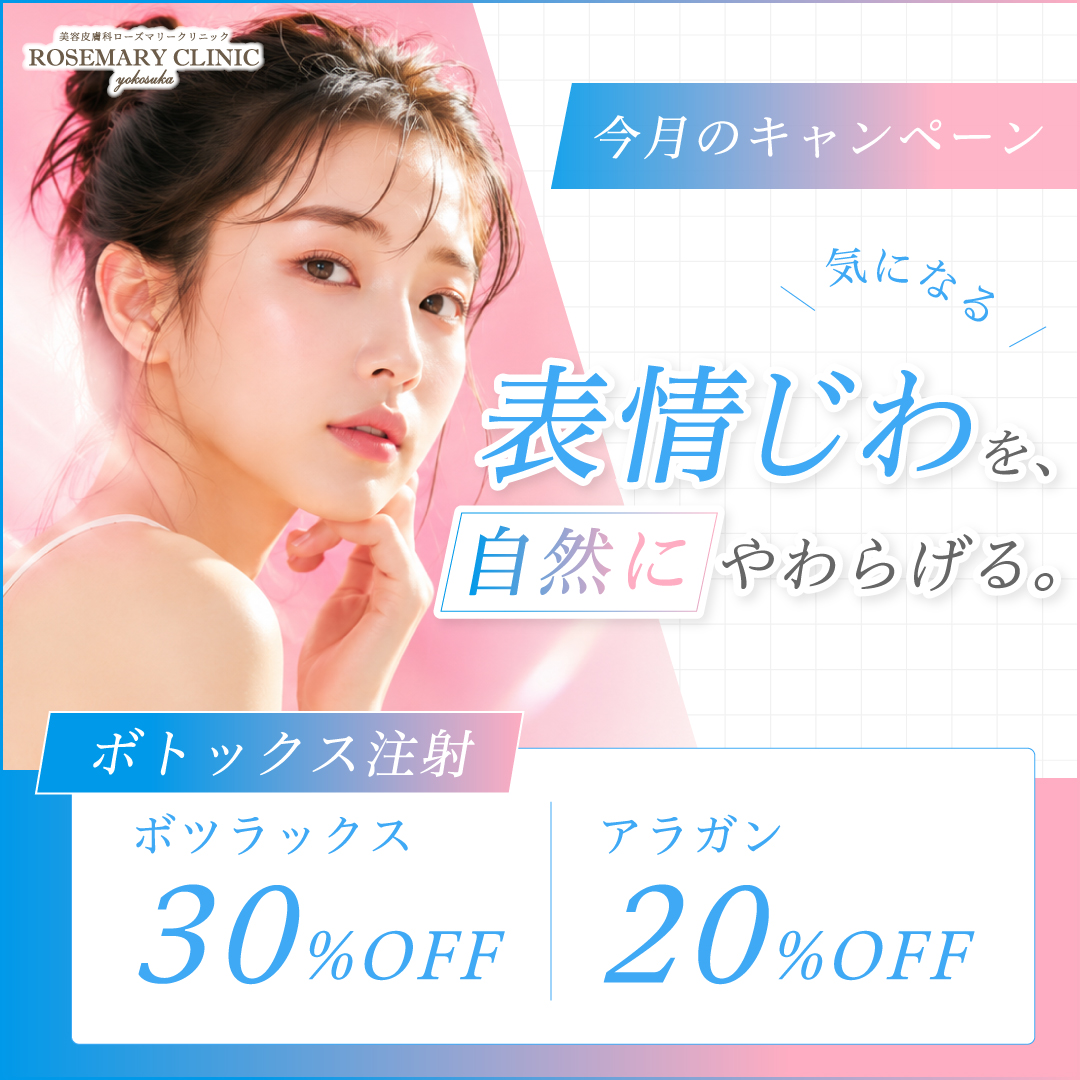 ボトックス注射　30～20%OFF